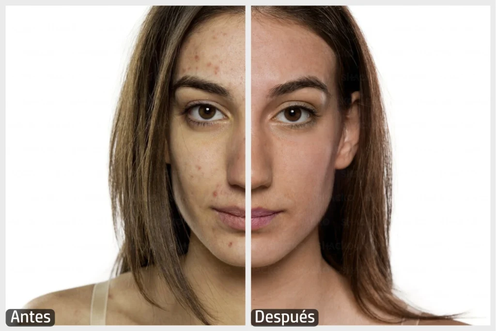 El antes y después de un portarretrato de una mujer joven en el cual se le ha removido manchas e imperfecciones en la piel y se ha corregido a un tono natural en cuanto al color de su cabello y piel del rostro.